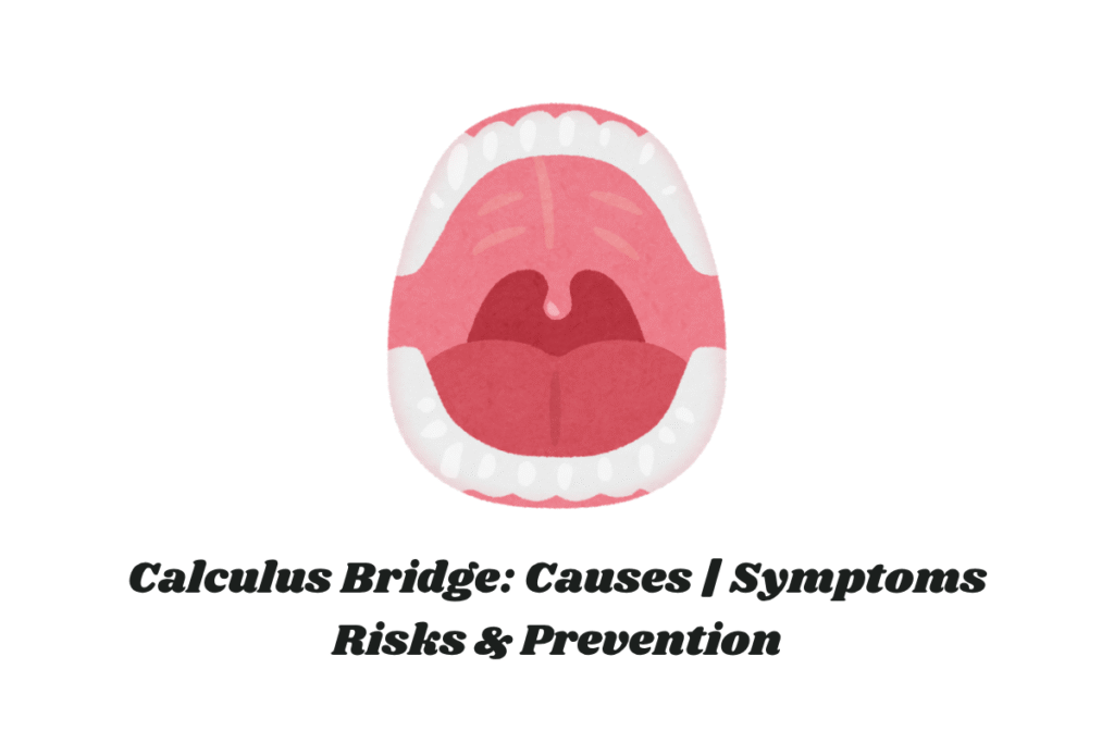 Calculus Bridge: Causes | Symptoms | Risks & Prevention