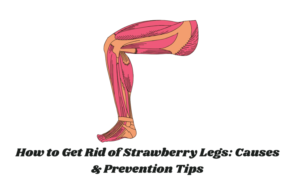 How to Get Rid of Strawberry Legs: Causes & Prevention Tips