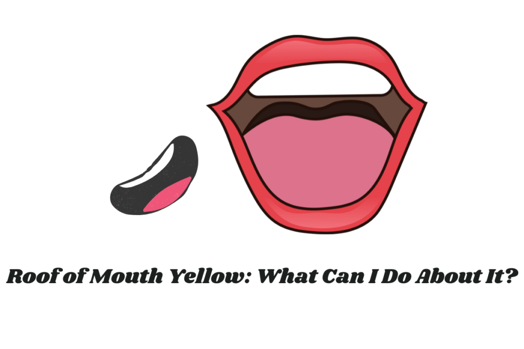 Roof of Mouth Yellow: What Can I Do About It?